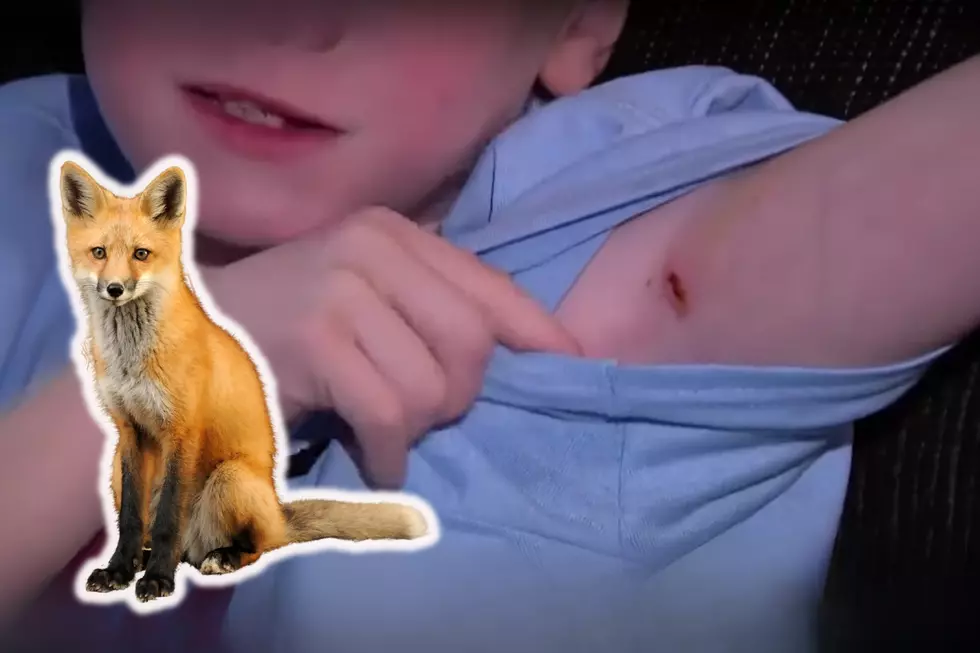 Massachusetts Boy and Two Dogs Attacked By Rabid Fox